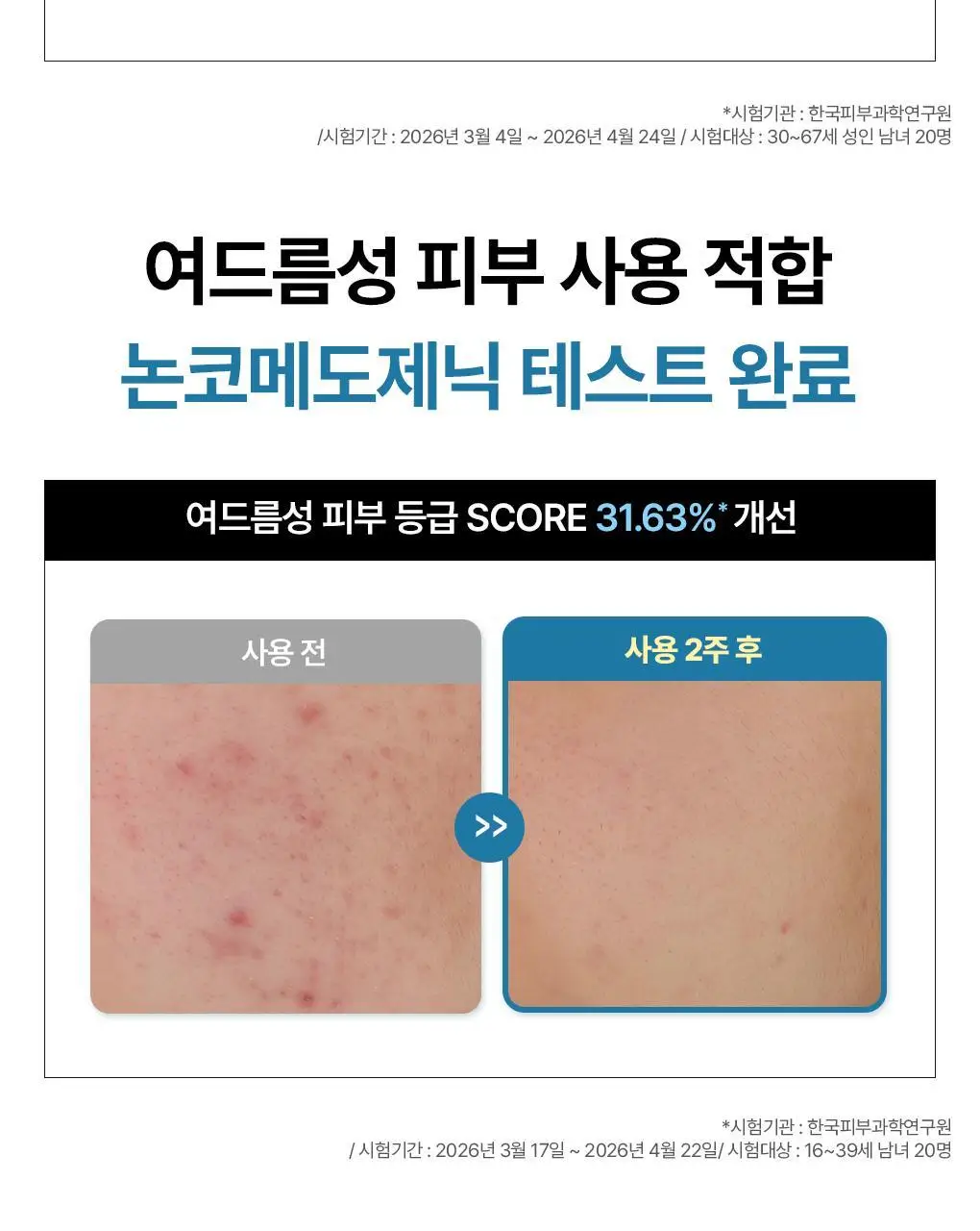 [앰플한병팩] 메디힐 하이퍼 마스크 1매 겔마스크 4종 (콜라겐/PDRN/마데카소사이드/히알루론산) 상세페이지 40